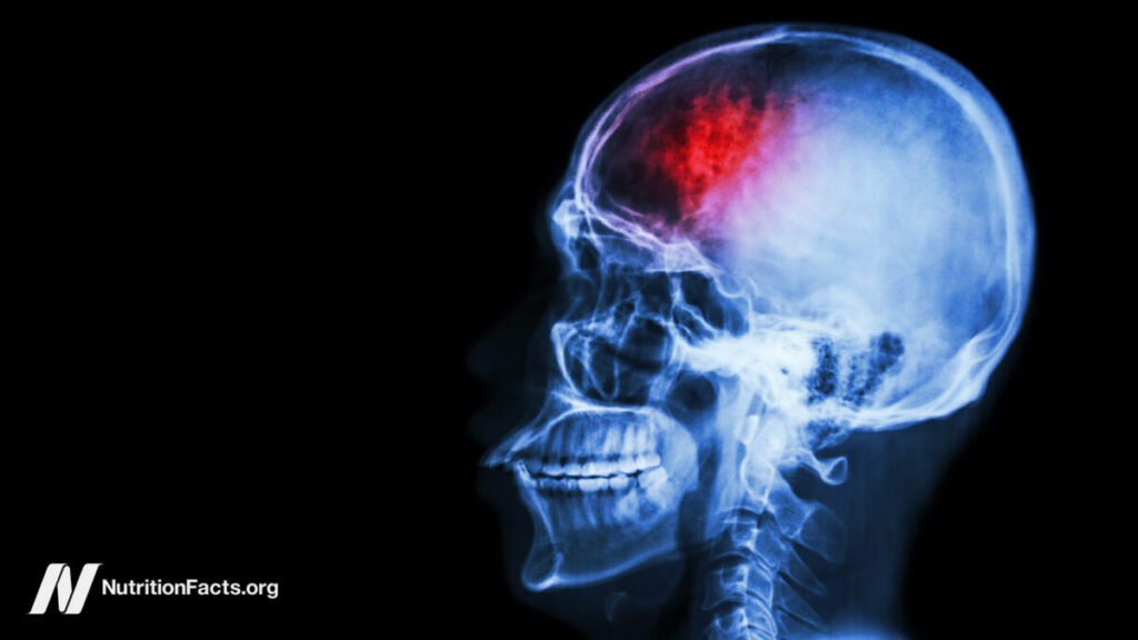 Fasting and Plant-Based Diets for Migraines and Traumatic Brain Injuries 