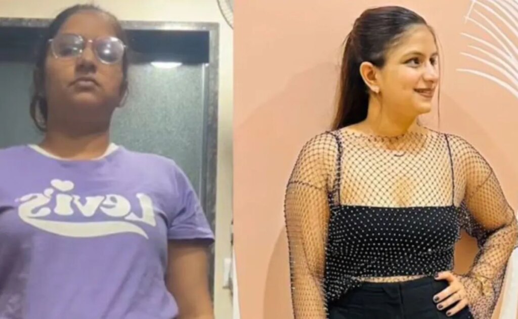 Woman Loses 12 KG In 3 Months, Nutritionist Shares Anti-Inflammatory Diet For Weight Loss